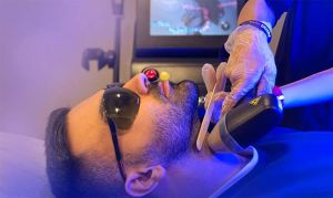لیزر موهای زائد
